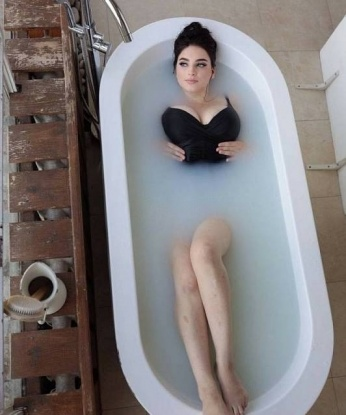 Альбина